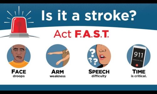 Act FAST After a Stroke