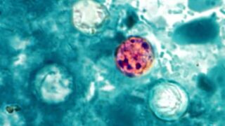 Amid Cyclospora Outbreak, Needham Experts Weigh in