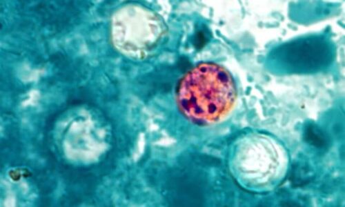 Amid Cyclospora Outbreak, Needham Experts Weigh in