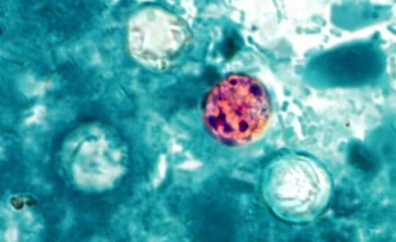 Amid Cyclospora Outbreak, Needham Experts Weigh in